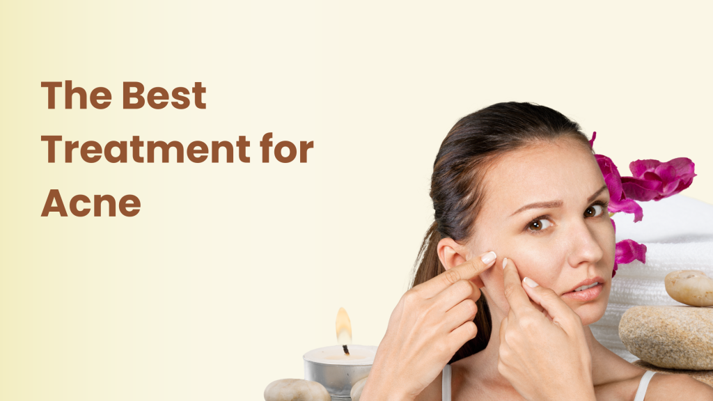 acne treatment Brampton