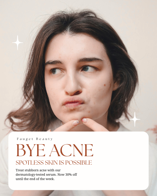 acne treatment Brampton