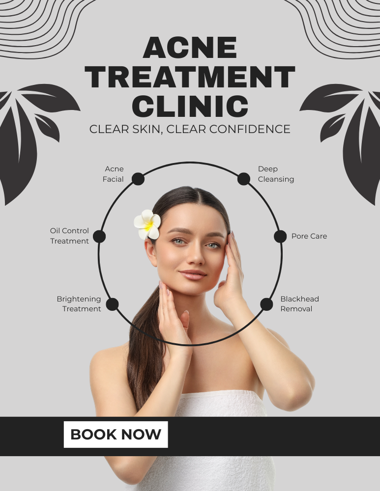 acne services in Brampton Ontario