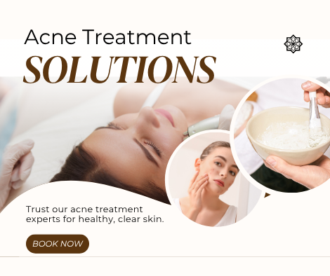 acne scar treatment Brampton