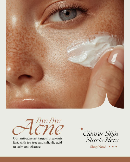 acne treatment near me Brampton