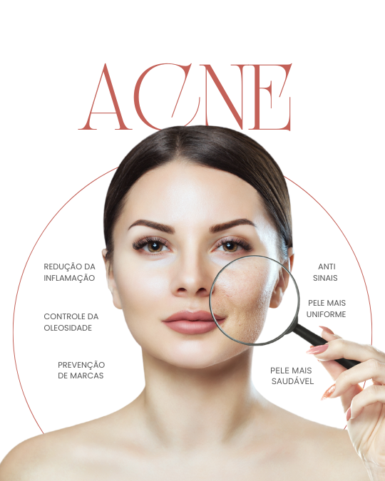 top rated acne treatment Brampton