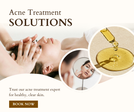 acne scar treatment near me Brampton