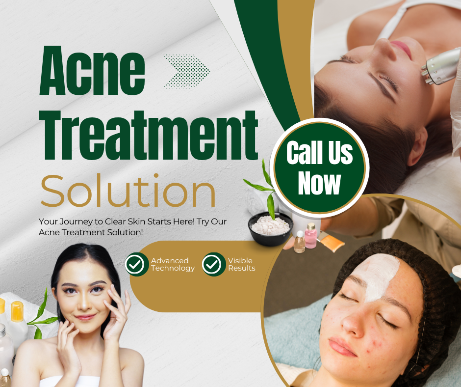 professional acne scar treatment Brampton