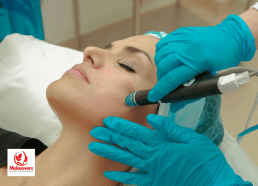 Laser Treatment Near Me Brampton
