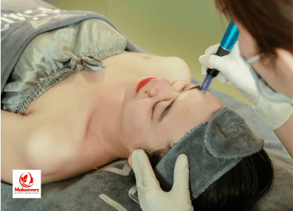 Microdermabrasion in Brampton